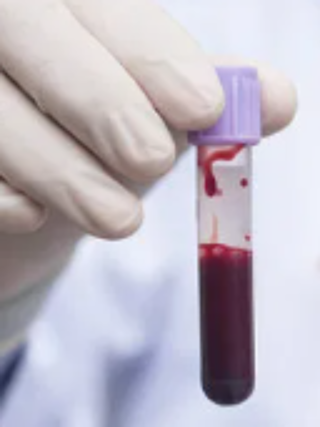 What is Rare Bombay Blood Group